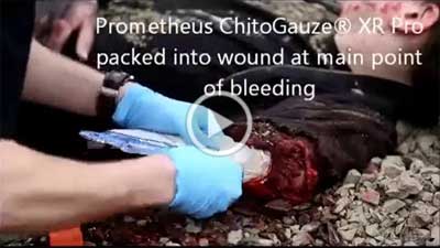  Control The Bleed Kit - ChitoGauze in the field.