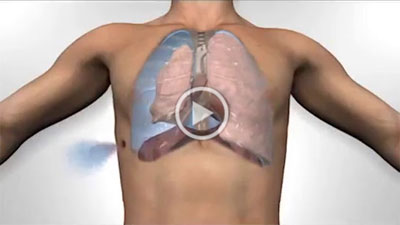 Control The Bleed Kit - Open Pneumothorax.